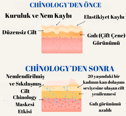 Chinology Gıdı Maskesi